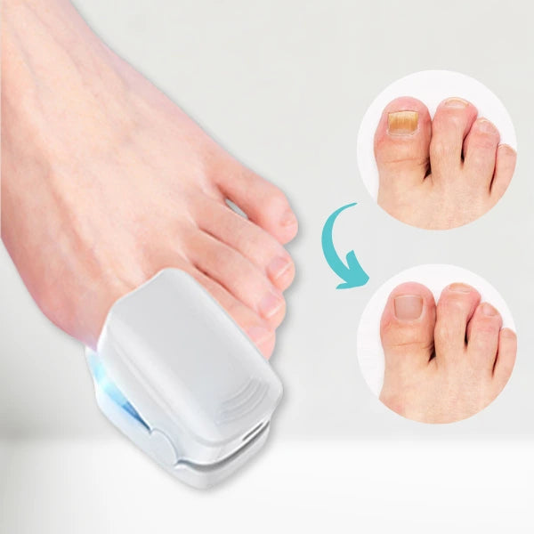 RevitaNail Nagelpilz Therapie