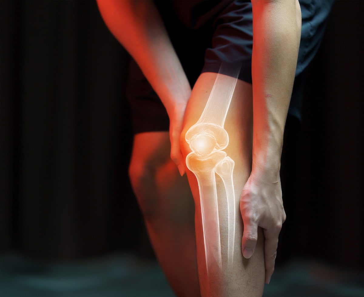 Die Wurzelursachen von Knieschmerzen entschlüsseln: Warum eine Knieoperation nicht die Lösung ist